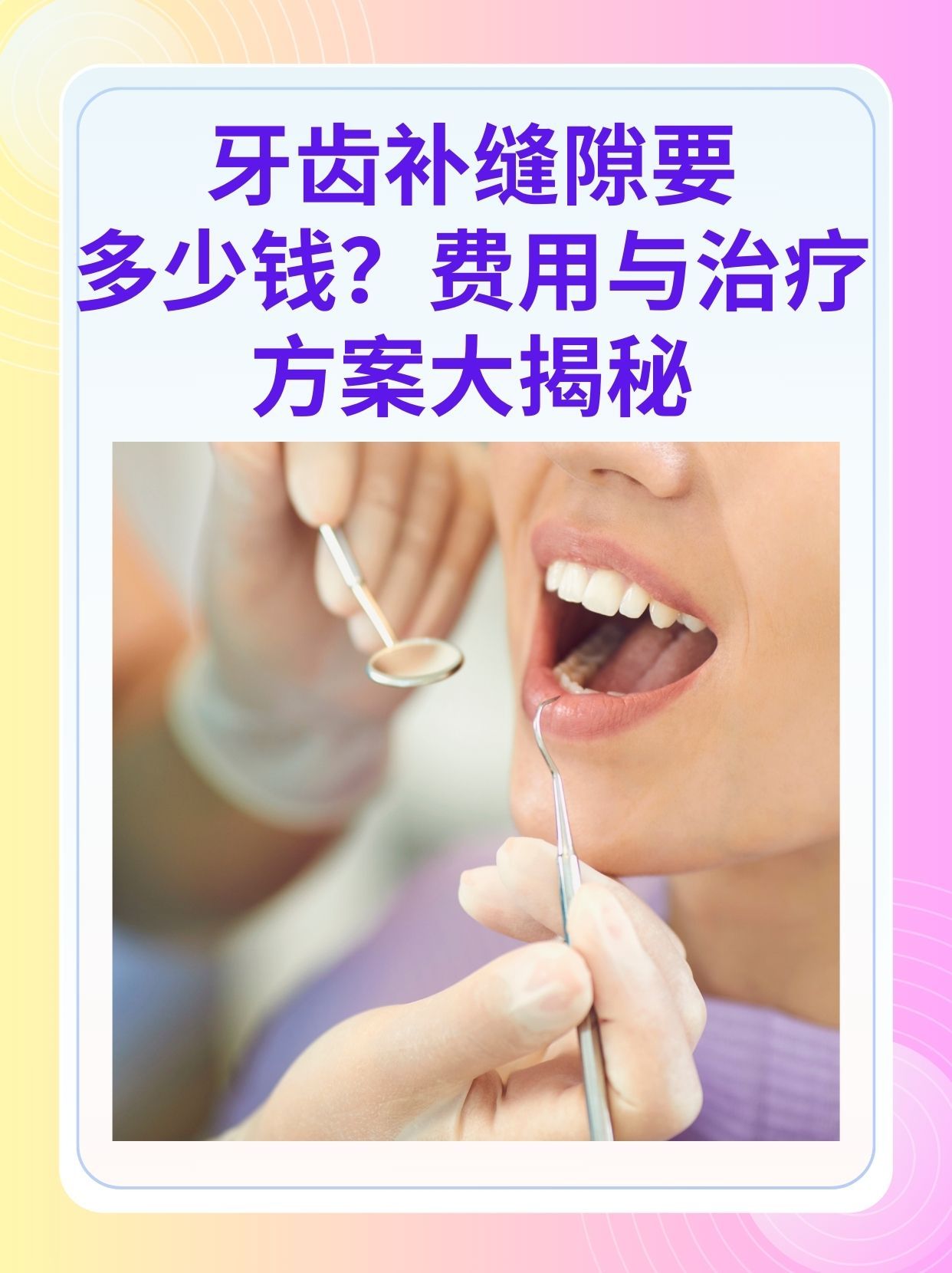 聊城补牙医保可以报销吗(补牙医保可以报销吗 哪些可以报销呢)